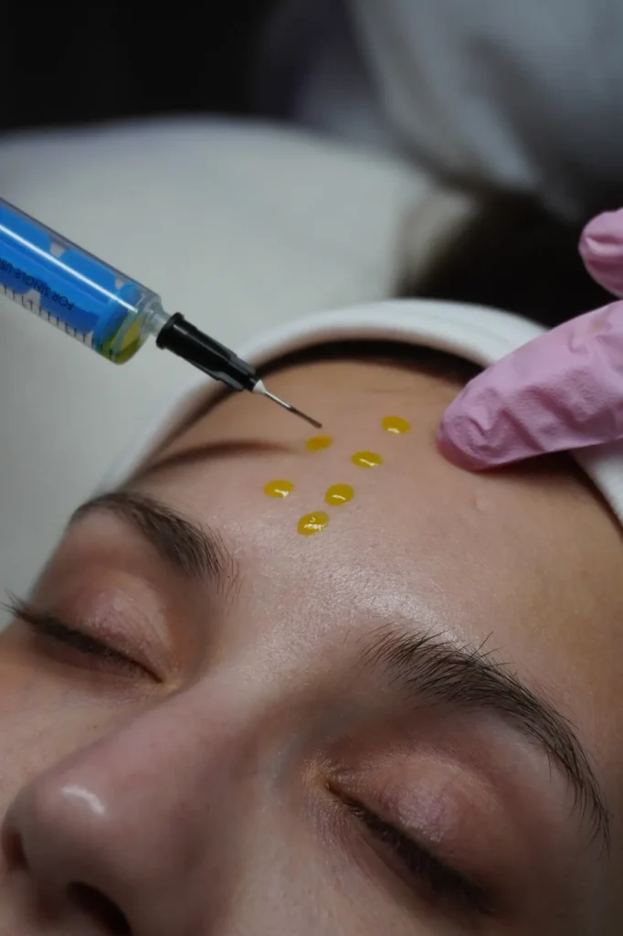 elf-beauty-biorepeel-1