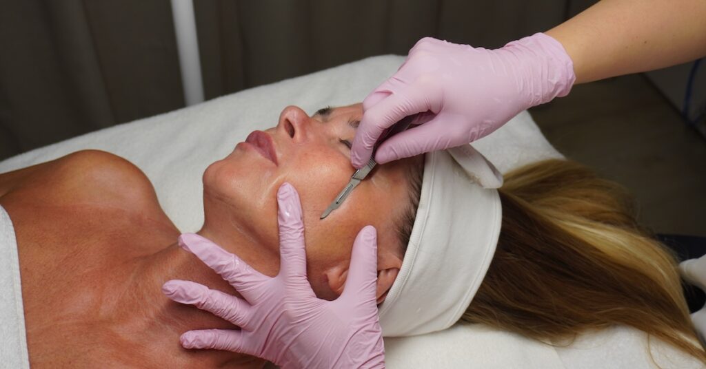 dermaplaning