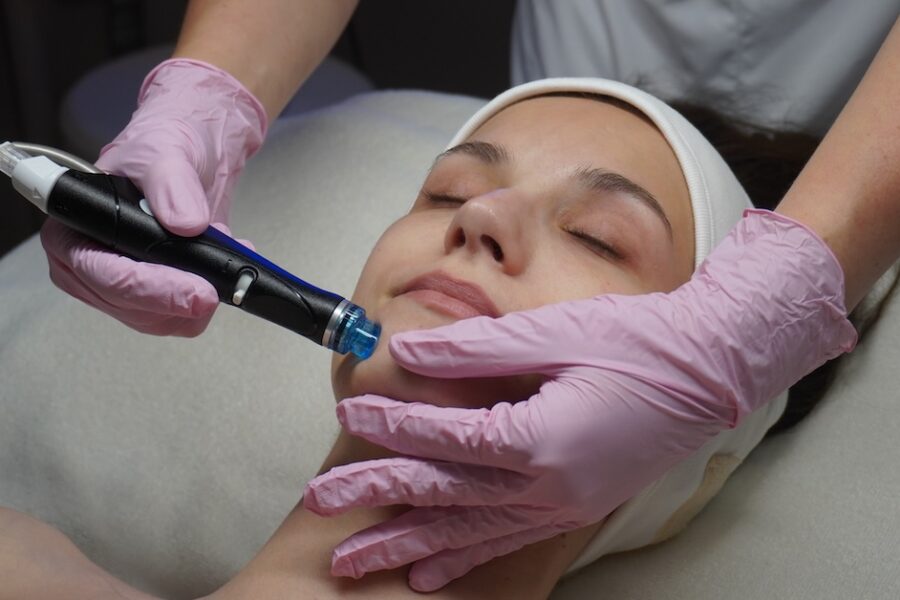 hĺbkové čistenie pokožky Bratislava