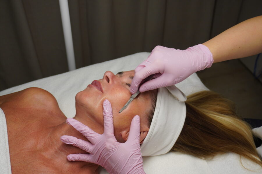 Dermaplaning Bratislava