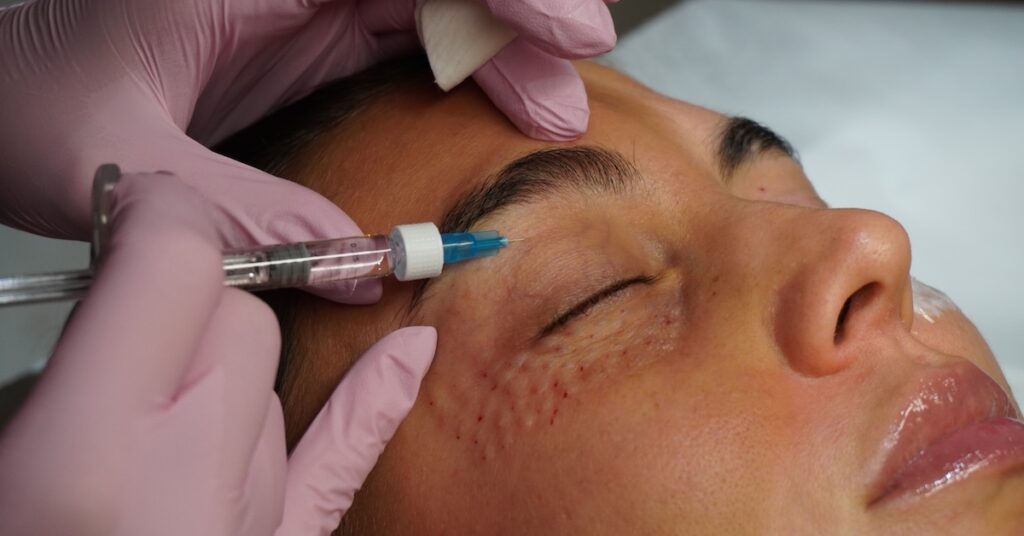 Lososie spermie Bratislava 