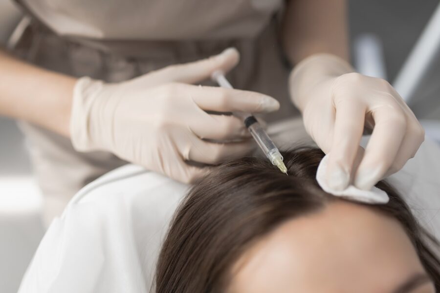 Zlepšenie hustoty vlasov pomocou Dermapen