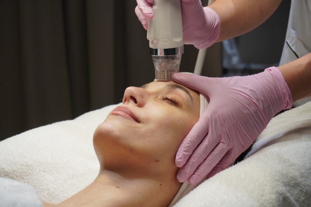 Mikroihličkovanie tváre s rádiofrekvencio