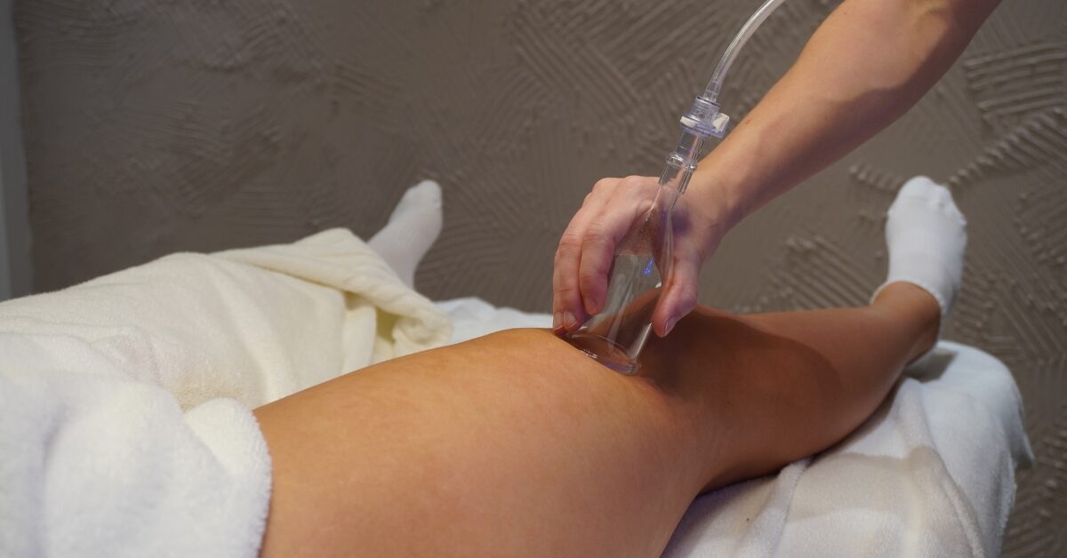 Lymfodrenáž pomocou sklenenej banky