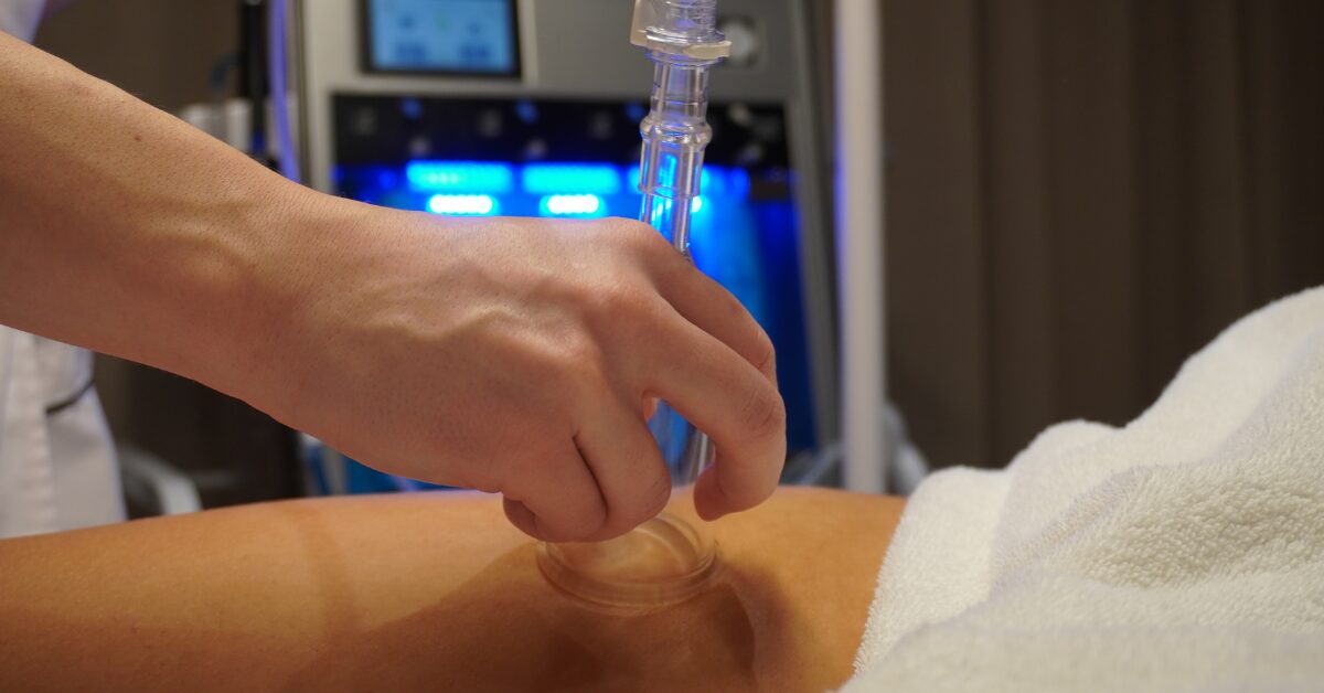 Lymfodrenáž pomocou sklenenej banky